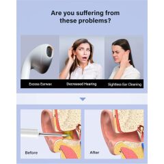 BEBIRD T5 3MP KAMERA 3.5MM LENS ŞARJLI WIFI GÖRÜNTÜLÜ KULAK TEMİZLEYİCİ BEYAZ RENK